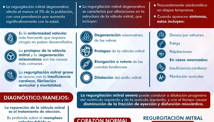 Regurgitación Mitral Degenerativa Regurgitación Mitral Degenerativa