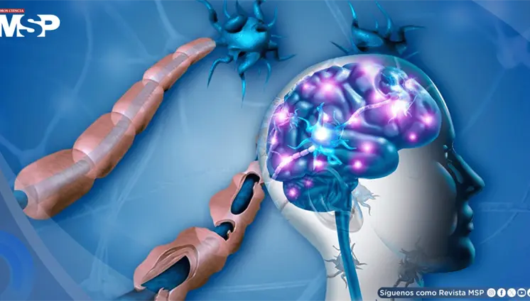 Virus de Epstein-Barr podría desencadenar ataques inmunitarios al cerebro que causan esclerosis múltiple Virus de Epstein-Barr podría desencadenar ataques inmunitarios al cerebro que causan esclerosis múltiple