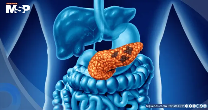 Micropl&aacute;sticos en el agua podr&iacute;an relacionarse con da&ntilde;o pancre&aacute;tico y favorecer la diabetes