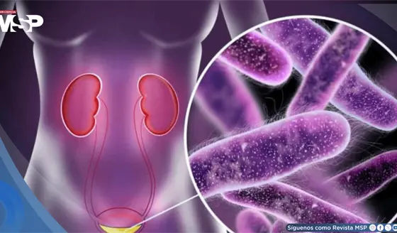 &iquest;Infecci&oacute;n urinaria o renal? C&oacute;mo diferenciarlas, prevenirlas y evitar la resistencia bacteriana
