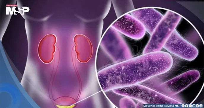 &iquest;Infecci&oacute;n urinaria o renal? C&oacute;mo diferenciarlas, prevenirlas y evitar la resistencia bacteriana
