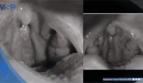 Faringitis bacteriana recurrente en mujer gestante requiri&oacute; manejo alternativo ante alergia a penicilina