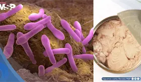 Retiran at&uacute;n enlatado en 9 estados de EE. UU. por riesgo de botulismo: &iquest;Qu&eacute; es y cu&aacute;les son sus s&iacute;ntomas?