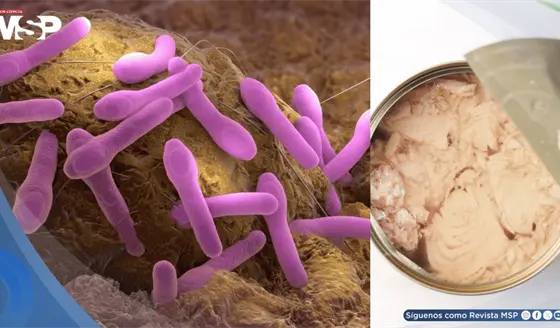 Retiran at&uacute;n enlatado en 9 estados de EE. UU. por riesgo de botulismo: &iquest;Qu&eacute; es y cu&aacute;les son sus s&iacute;ntomas?