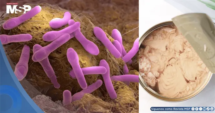 Retiran at&uacute;n enlatado en 9 estados de EE. UU. por riesgo de botulismo: &iquest;Qu&eacute; es y cu&aacute;les son sus s&iacute;ntomas?