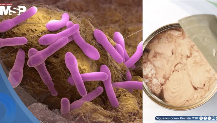 Retiran atún enlatado en 9 estados de EE. UU. por riesgo de botulismo: ¿Qué es y cuáles son sus síntomas? Retiran atún enlatado en 9 estados de EE. UU. por riesgo de botulismo: ¿Qué es y cuáles son sus síntomas?