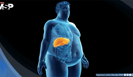 Obesidad e hipertensi&oacute;n podr&iacute;an ser causas directas de demencia, revela estudio