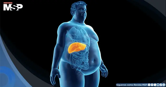 Obesidad e hipertensión podrían ser causas directas de demencia, revela estudio Obesidad e hipertensión podrían ser causas directas de demencia, revela estudio