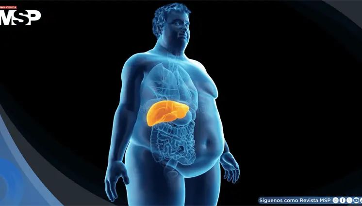 Obesidad e hipertensión podrían ser causas directas de demencia, revela estudio Obesidad e hipertensión podrían ser causas directas de demencia, revela estudio