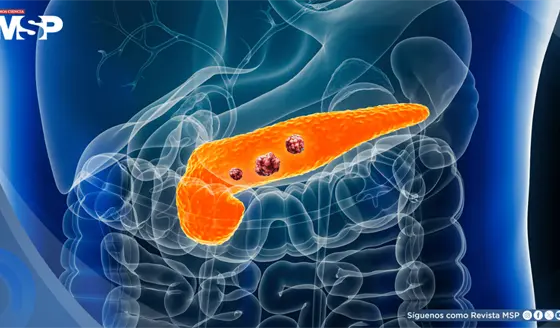 Cient&iacute;ficos lograr&iacute;an eliminar tumores pancre&aacute;ticos en modelos animales evitando resistencias: Estudio
