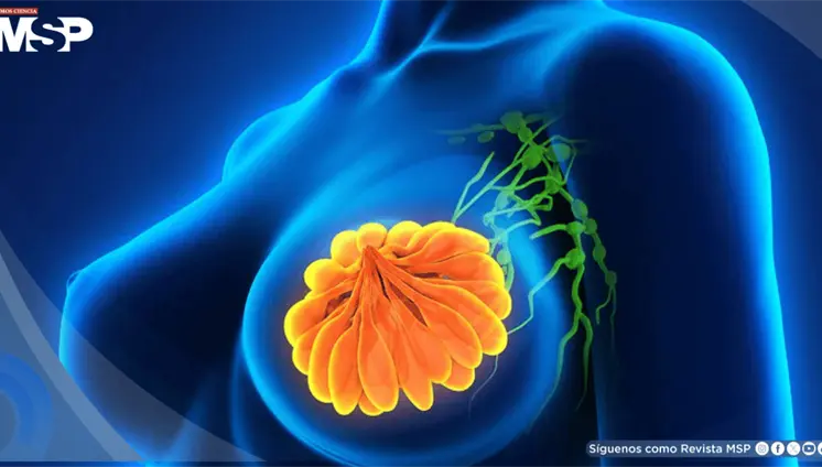 Inhibidor CDK 4/6 prolonga 15 meses supervivencia en pacientes con cáncer de mama metastásico HR+ y HER2+ Inhibidor CDK 4/6 prolonga 15 meses supervivencia en pacientes con cáncer de mama metastásico HR+ y HER2+