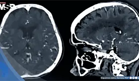 Trastorno Dependiente de la Personalidad en adulta joven con miedo al abandono y ansiedad