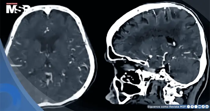 Trastorno Dependiente de la Personalidad en adulta joven con miedo al abandono y ansiedad Trastorno Dependiente de la Personalidad en adulta joven con miedo al abandono y ansiedad
