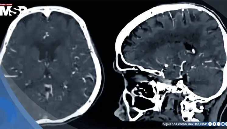 Trastorno Dependiente de la Personalidad en adulta joven con miedo al abandono y ansiedad Trastorno Dependiente de la Personalidad en adulta joven con miedo al abandono y ansiedad