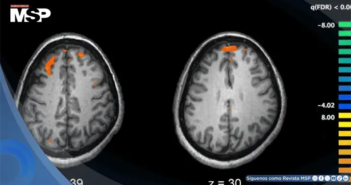 Desapego social y restricci&oacute;n afectiva en mujer resulta en trastorno de personalidad esquizoide