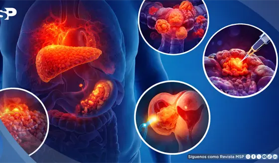 Avances oncol&oacute;gicos recientes que generan esperanza: entusiasmo justificado, pero con rigor y paciencia