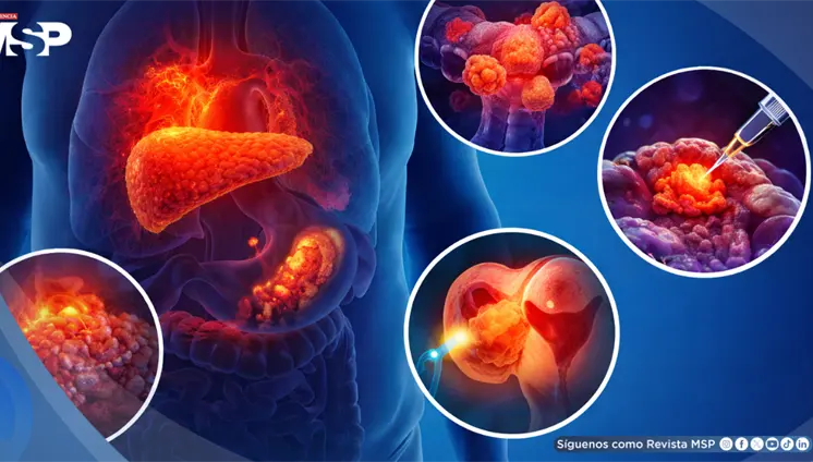 Avances oncológicos recientes que generan esperanza: entusiasmo justificado, pero con rigor y paciencia Avances oncológicos recientes que generan esperanza: entusiasmo justificado, pero con rigor y paciencia