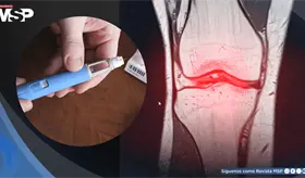 Semaglutida podr&iacute;a frenar la artrosis al proteger el cart&iacute;lago, m&aacute;s all&aacute; de la p&eacute;rdida de peso: Estudio