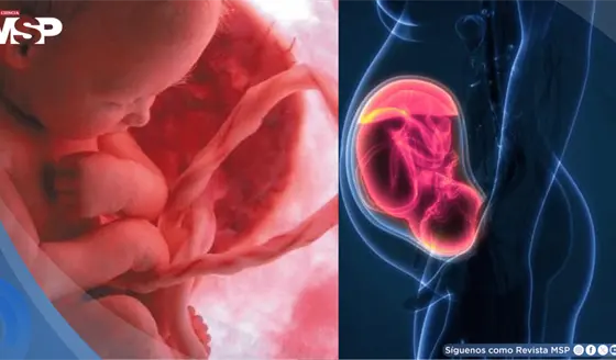 Desarrollan IA capaz de detectar placenta accreta, una complicaci&oacute;n mortal del embarazo