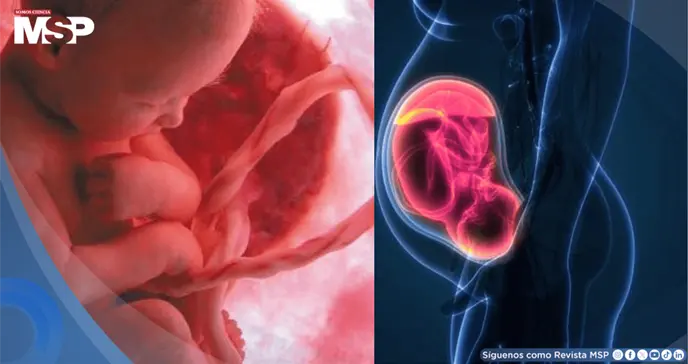 Desarrollan IA capaz de detectar placenta accreta, una complicaci&oacute;n mortal del embarazo