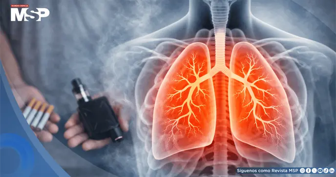 Efectos en la salud del vapeo y el tabaquismo ¿Cuáles son las similitudes y diferencias clínicas? Efectos en la salud del vapeo y el tabaquismo ¿Cuáles son las similitudes y diferencias clínicas?