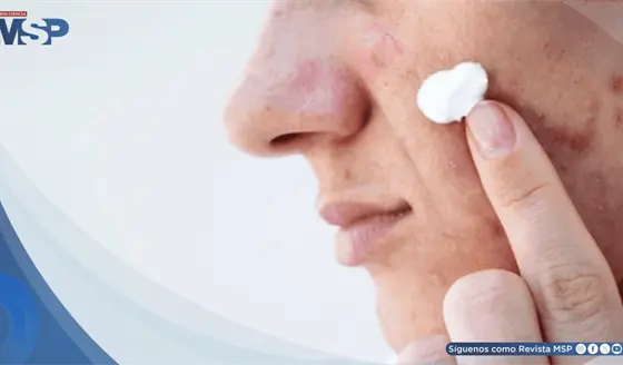 Skincare viral en redes podr&iacute;a causar quemaduras, manchas y hasta lesiones precancer&iacute;genas