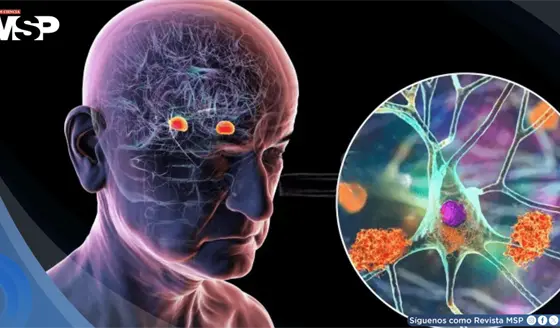 Un an&aacute;lisis de sangre podr&iacute;a predecir el alzh&eacute;imer hasta 20 a&ntilde;os antes de que aparezcan los s&iacute;ntomas