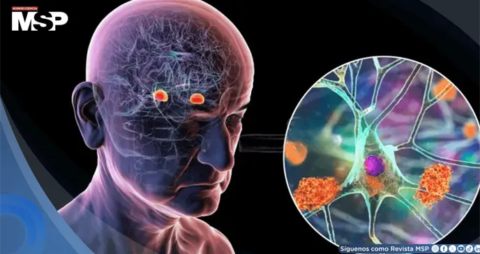 Un an&aacute;lisis de sangre podr&iacute;a predecir el alzh&eacute;imer hasta 20 a&ntilde;os antes de que aparezcan los s&iacute;ntomas