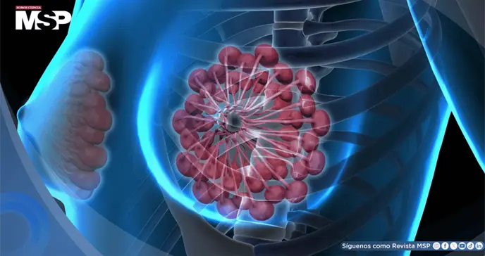 Cáncer de mama crecerá 34% en el 2050 y podría causar 1,4 millones de muertes al año: Estudio Cáncer de mama crecerá 34% en el 2050 y podría causar 1,4 millones de muertes al año: Estudio