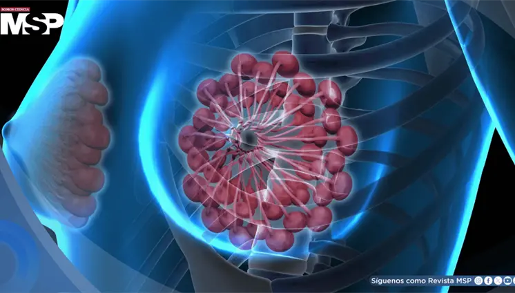 C&aacute;ncer de mama crecer&aacute; 34% en el 2050 y podr&iacute;a causar 1,4 millones de muertes al a&ntilde;o: Estudio